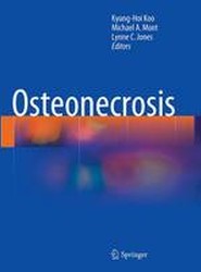 Osteonecrosis