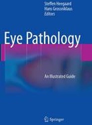 Eye Pathology
