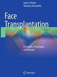 Face Transplantation