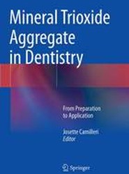Mineral Trioxide Aggregate in Dentistry