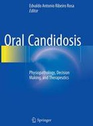 Oral Candidosis
