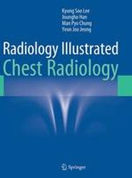 Radiology Illustrated: Chest Radiology