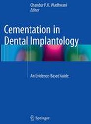 Cementation in Dental Implantology