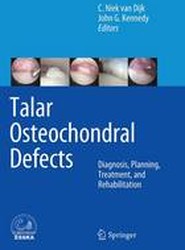Talar Osteochondral Defects