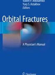 Orbital Fractures