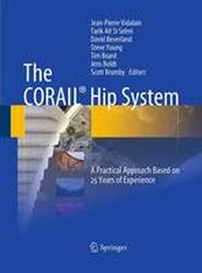 The CORAIL (R) Hip System