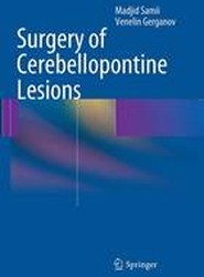 Surgery of Cerebellopontine Lesions