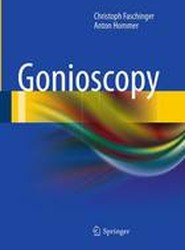 Gonioscopy