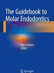 The Guidebook to Molar Endodontics