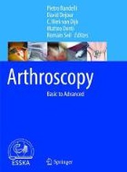 Arthroscopy