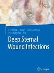 Deep Sternal Wound Infections