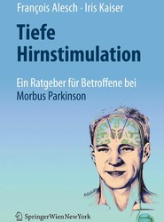 Tiefe Hirnstimulation: Ein Ratgeber fur Betroffene bei Morbus Parkinson