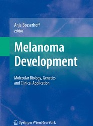 Melanoma Development