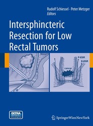 Intersphincteric Resection for Low Rectal Tumors