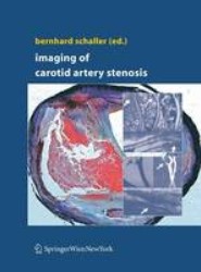 Imaging of Carotid Artery Stenosis