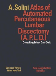 Atlas of Automated Percutaneous Lumbar Discectomy (A.P.L.D.)