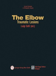 The Elbow