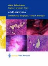 Endometriose
