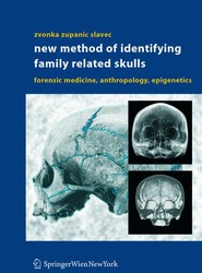 New Method of Identifying Family Related Skulls