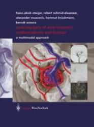 Neurosurgery of Arteriovenous Malformations and Fistulas