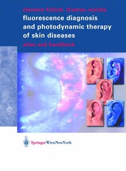 Fluorescence Diagnosis and Photodynamic Therapy of Skin Diseases
