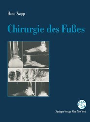 Chirurgie des Fusses