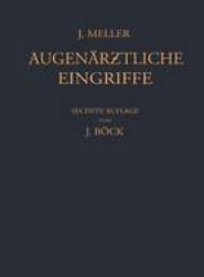 Augenarztliche Eingriffe