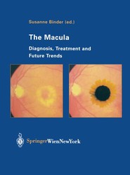 The Macula