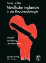 Metallische Implantate in der Knochenchirurgie
