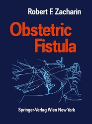 Obstetric Fistula