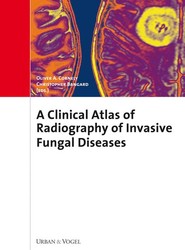 Atlas of Radiography and Clinics of Invasive Fungal Infections