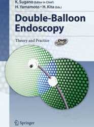 Double-Balloon Endoscopy