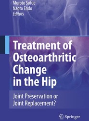 Treatment of Osteoarthritic Change in the Hip