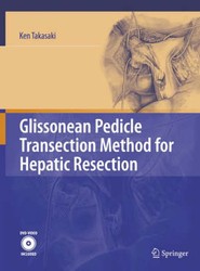 Glissonean Pedicle Transection Method for Hepatic Resection