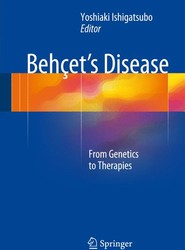 Behcet's Disease