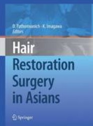 Hair Restoration Surgery in Asians