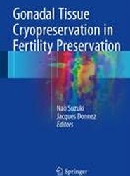 Gonadal Tissue Cryopreservation in Fertility Preservation