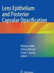Lens Epithelium and Posterior Capsular Opacification