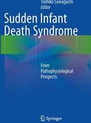 Sudden Infant Death Syndrome