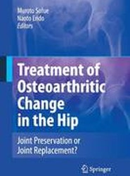 Treatment of Osteoarthritic Change in the Hip