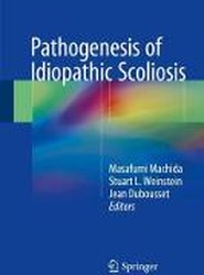 Pathogenesis of Idiopathic Scoliosis
