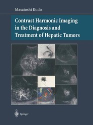 Contrast Harmonic Imaging in the Diagnosis and Treatment of Hepatic Tumors