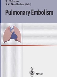 Pulmonary Embolism