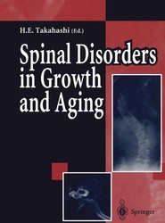 Spinal Disorders in Growth and Aging