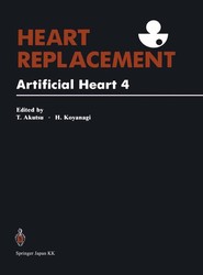 Heart Replacement