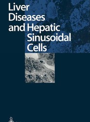 Liver Diseases and Hepatic Sinusoidal Cells