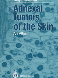 Adnexal Tumors of the Skin