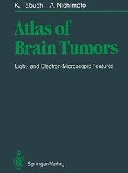 Atlas of Brain Tumors