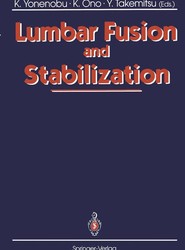 Lumbar Fusion and Stabilization