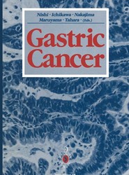 Gastric Cancer